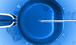 �̼��������Լ�