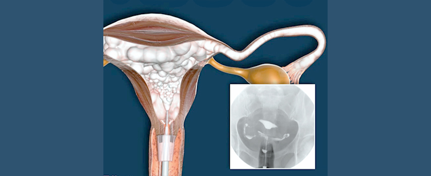 �ڱó��Ȱ� X-RAY ������