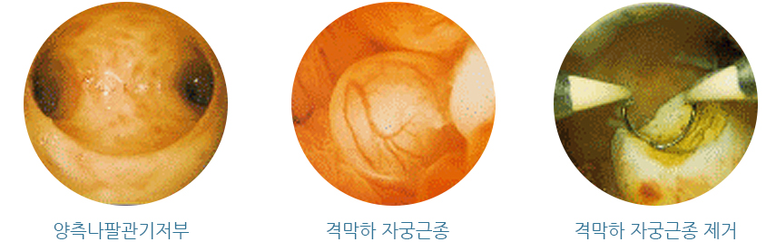 �ڱð� �˻�