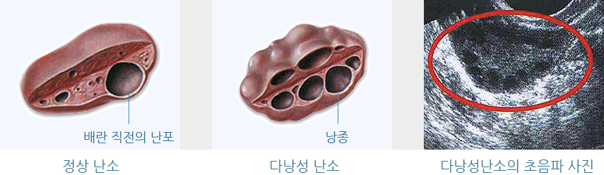 �ٳ��� ����